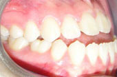 Caso Cirugia Maxilofacial